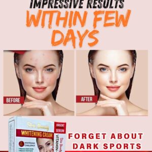 Exfoliator Whitening Cream